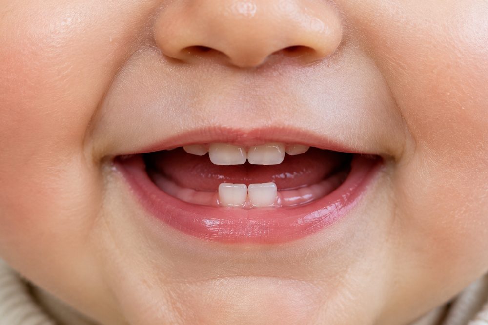 Spucken beim Beikoststart: Wann es harmlos ist